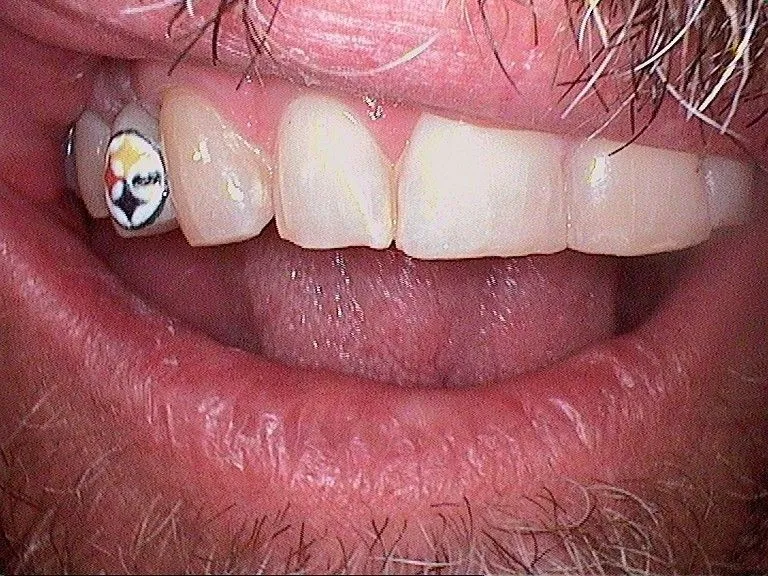 implants-page gallery