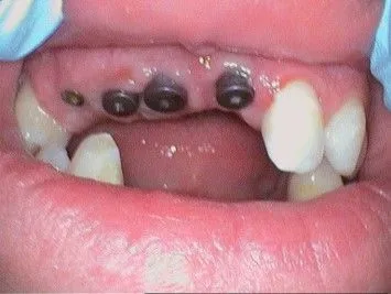 implants-page gallery